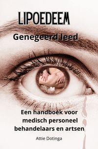 Produktbild: Lipoedeem