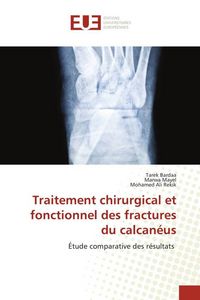 Produktbild: Bardaa, T: Traitement chirurgical et fonctionnel des fractur
