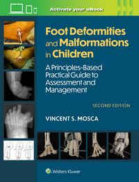 Produktbild: Foot Deformities and Malformations in Children
