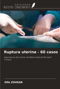 Produktbild: Ruptura uterina - 60 casos