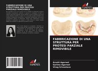Produktbild: Fabbricazione Di Una Struttura Per Protesi Parziale Rimovibile