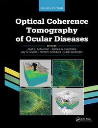 Produktbild: Optical Coherence Tomography of Ocular Diseases