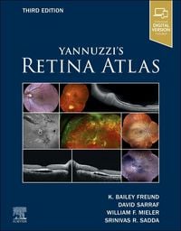 Produktbild: Yannuzzi's Retina Atlas