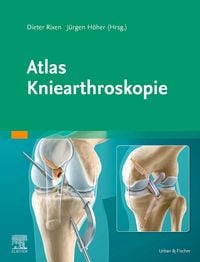 Produktbild: Atlas Kniearthroskopie