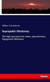 Produktbild: Suprapubic lithotomy: