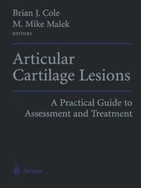 Produktbild: Articular Cartilage Lesions