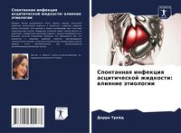 Produktbild: Spontannaq infekciq asciticheskoj zhidkosti: wliqnie &auml;tiologii