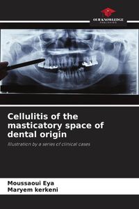Produktbild: Cellulitis of the masticatory space of dental origin