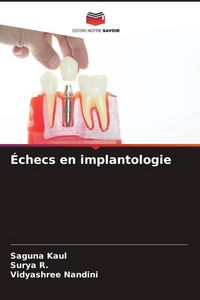 Produktbild: &Eacute;checs en implantologie