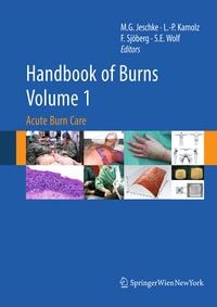 Produktbild: Handbook of Burns Volume 1