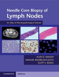 Produktbild: Needle Core Biopsy Of Lymph No