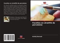 Produktbild: Facettes en stratifi&eacute; de porcelaine