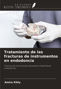 Produktbild: Tratamiento de las fracturas de instrumentos en endodoncia