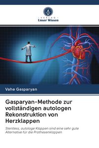 Produktbild: Gasparyan-Methode zur vollst&auml;ndigen autologen Rekonstruktion von Herzklappen