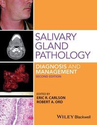 Produktbild: Salivary Gland Pathology