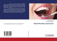 Produktbild: Rapid Maxillary Expansion