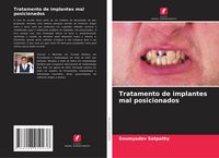Produktbild: Tratamento de implantes mal posicionados