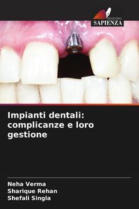Produktbild: Impianti dentali: complicanze e loro gestione