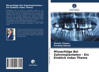 Produktbild: Misserfolge Bei Zahnimplantaten - Ein Einblick Indas Thema