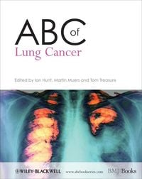 Produktbild: ABC of Lung Cancer