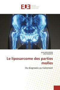 Produktbild: Le liposarcome des parties molles