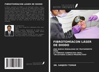 Produktbild: Fibrotom&iacute;acon L&aacute;ser De Diodo