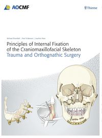 Produktbild: Principles of Internal Fixation of the Craniomaxillofacial Skeleton