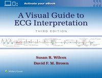 Produktbild: A Visual Guide to ECG Interpretation: Print + eBook with Multimedia