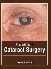 Produktbild: Essentials of Cataract Surgery