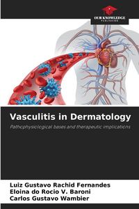 Produktbild: Vasculitis in Dermatology