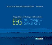 Produktbild: Atlas of Electroencephalography : Neurology and critical care - Volume 3
