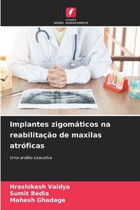 Produktbild: Implantes zigom&aacute;ticos na reabilita&ccedil;&atilde;o de maxilas atr&oacute;ficas
