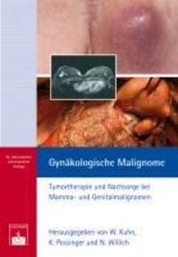 Produktbild: Gyn&auml;kologische Malignome