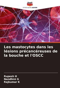 Produktbild: Les mastocytes dans les l&eacute;sions pr&eacute;canc&eacute;reuses de la bouche et l'OSCC