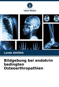 Produktbild: Bildgebung bei endokrin bedingten Osteoarthropathien