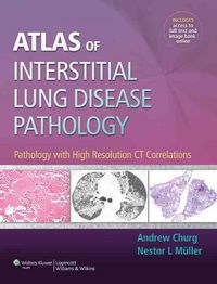 Produktbild: Churg, A: Atlas of Interstitial Lung Disease Pathology