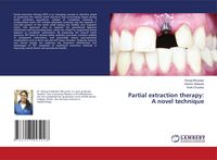 Produktbild: Partial extraction therapy: A novel technique