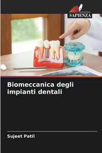 Produktbild: Biomeccanica degli impianti dentali