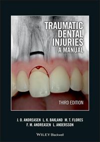Produktbild: Traumatic Dental Injuries