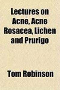 Produktbild: Lectures on Acne, Acne Rosacea, Lichen and Prurigo