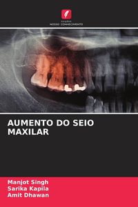 Produktbild: Aumento Do Seio Maxilar