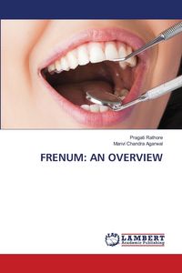 Produktbild: Frenum: An Overview
