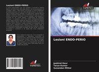 Produktbild: Lesioni Endo-Perio