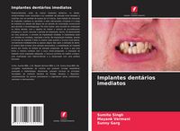 Produktbild: Implantes dent&aacute;rios imediatos