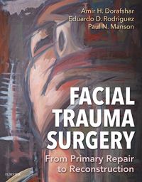 Produktbild: Facial Trauma Surgery E-Book