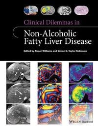 Produktbild: Clinical Dilemmas in Non-Alcoholic Fatty Liver Disease