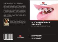 Produktbild: Distalisation des Molaires