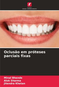 Produktbild: Oclus&atilde;o em pr&oacute;teses parciais fixas