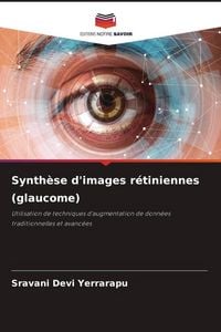 Produktbild: Synth&egrave;se d'images r&eacute;tiniennes (glaucome)