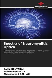 Produktbild: Spectra of Neuromyelitis Optica